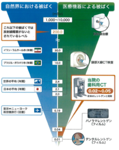 歯科用CT　被ばく量