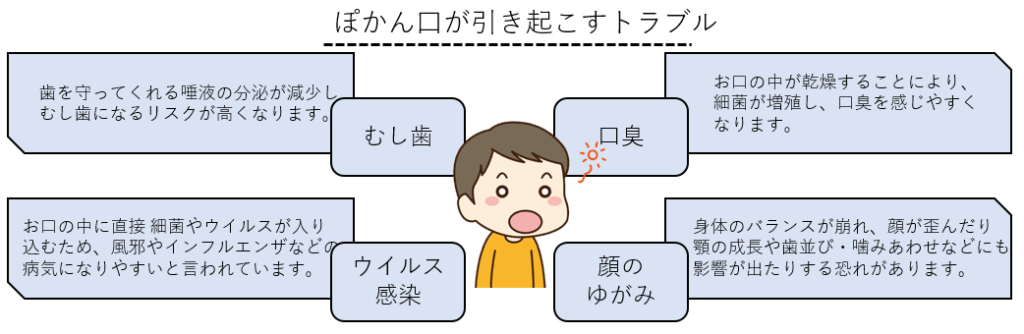 ぽかん口