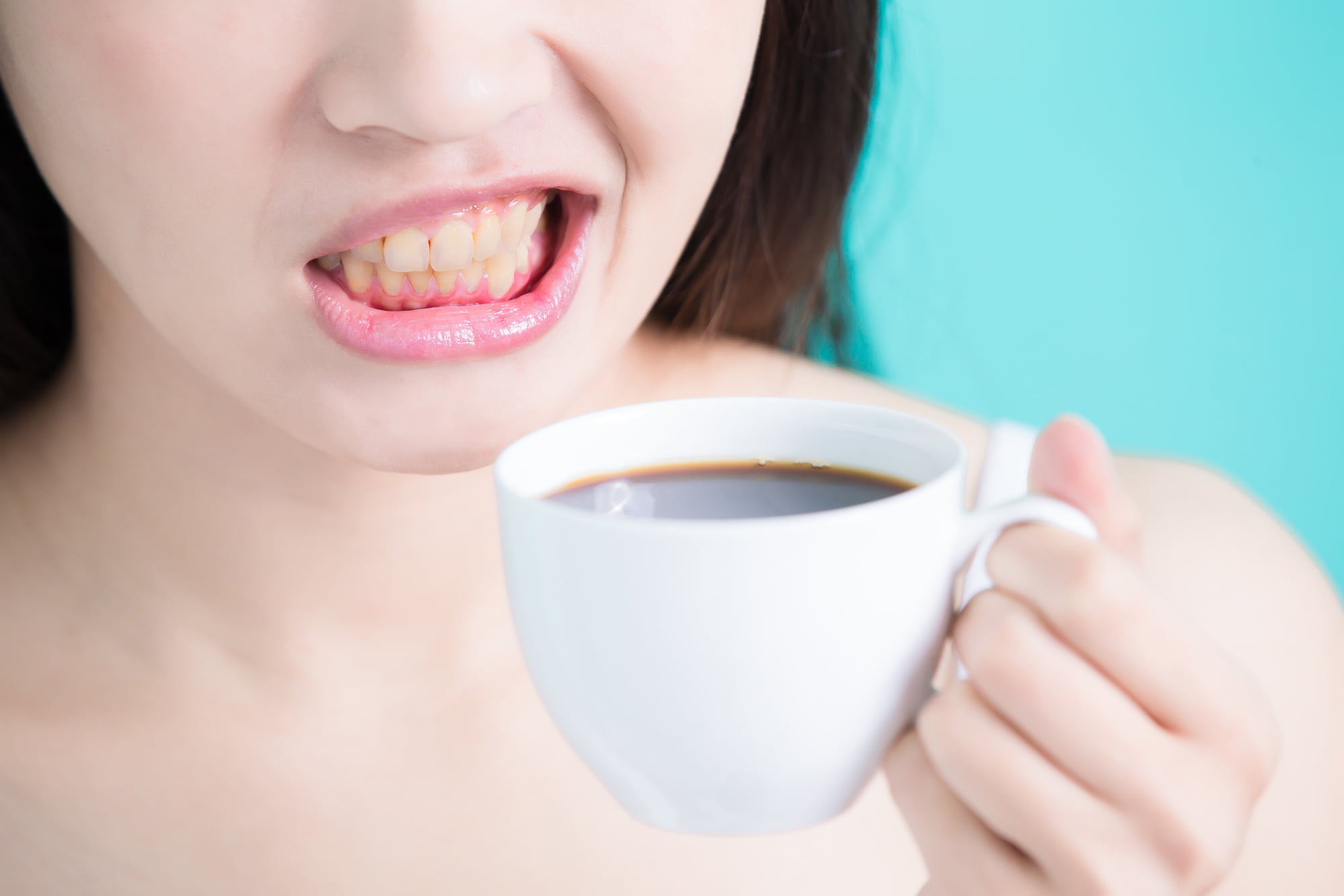 コーヒーで着色した歯に口をゆがめる人